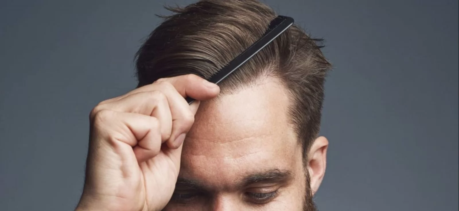 Hair Transplant