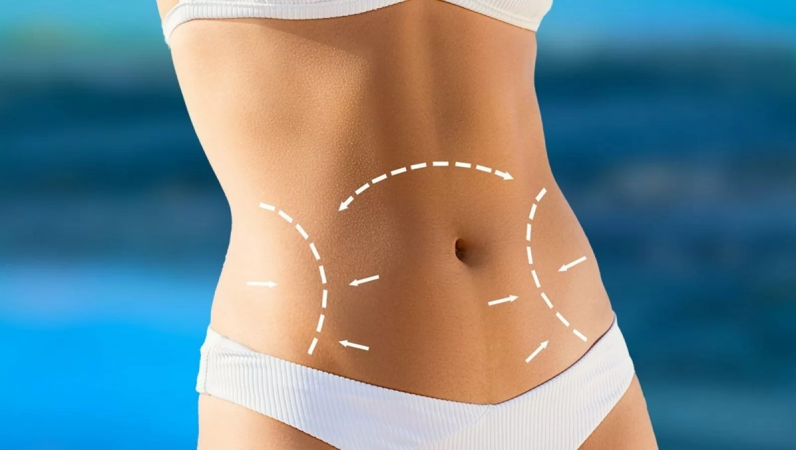 Liposuction